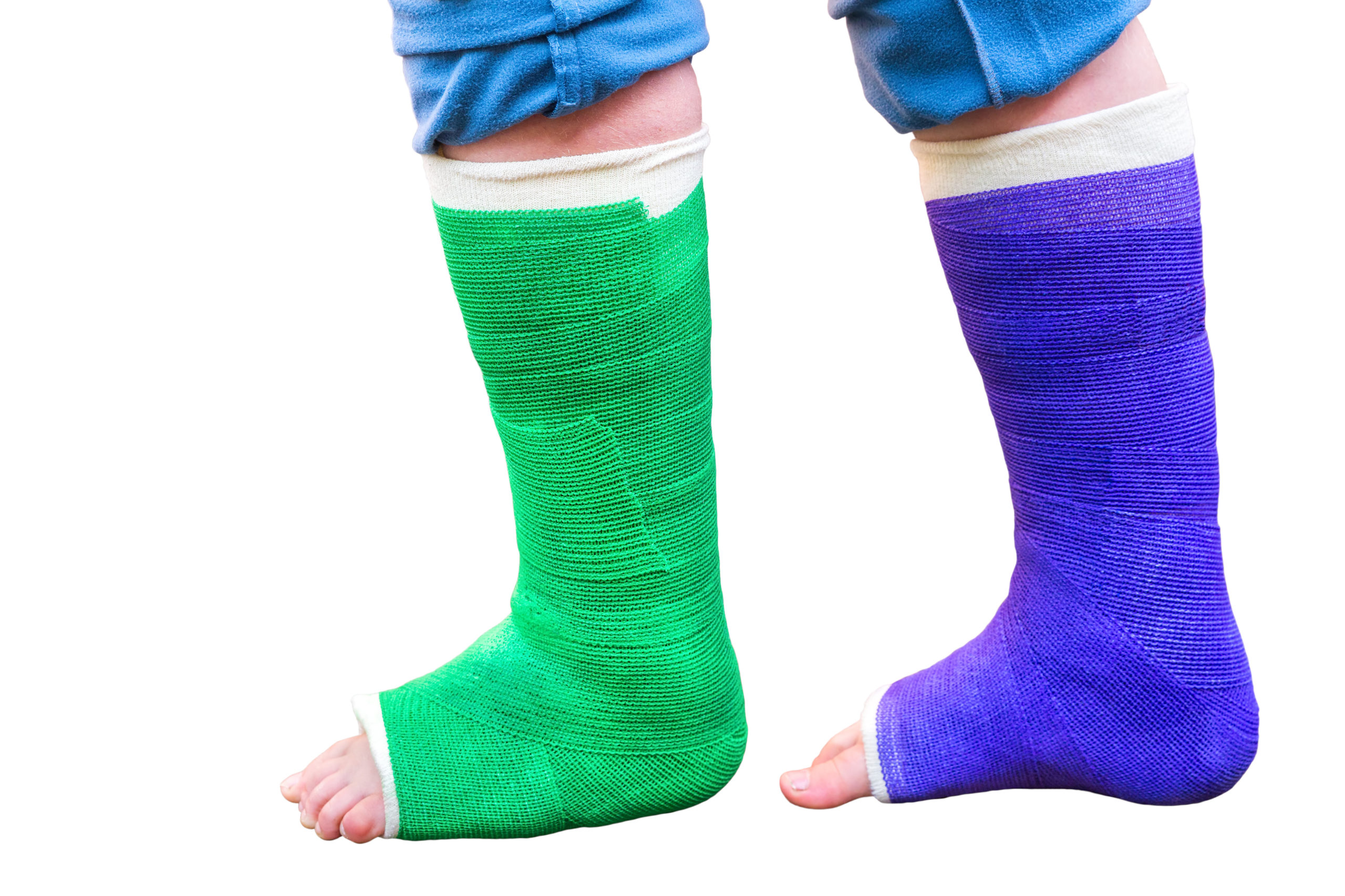 casts use in orthopaedics