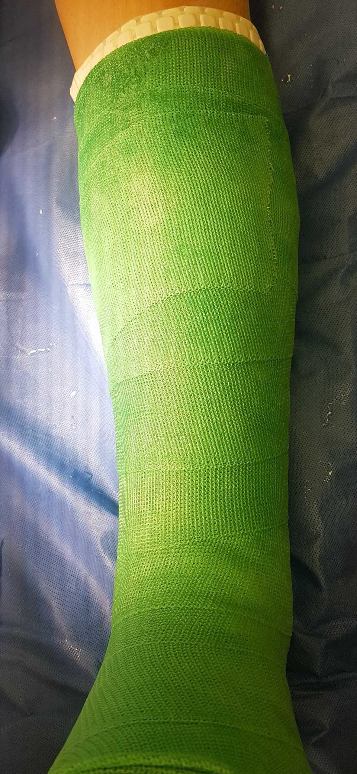 waterproof cast