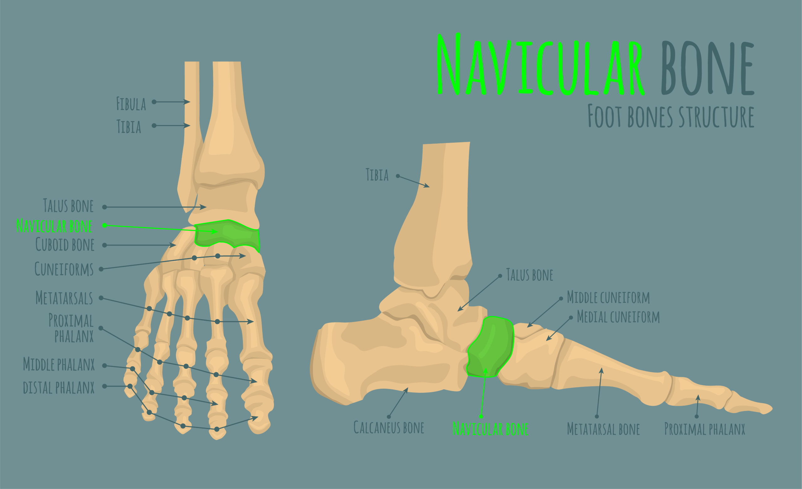 Accessory Navicular Removal The Recovery Process Little Growing Bones Accessory Navicular Removal The Recovery Process Little Growing Bones